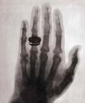 Обручальное кольцо жены рентгена